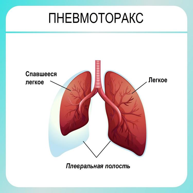 Задать вопрос онкологу, хирургу, колопроктологу