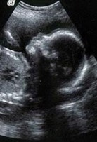 Обложка произведения Двадцать первая хромосома